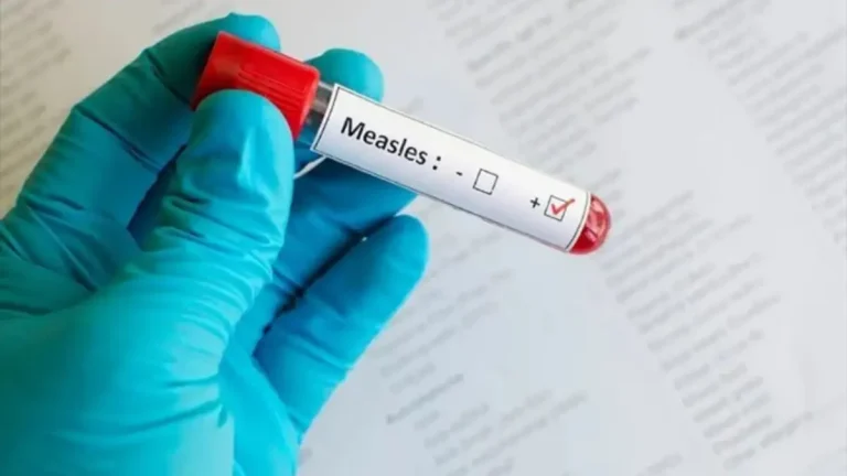 Gauteng Launches Mass Measles-Rubella Vaccination Campaign to Protect Children Gauteng Launches Mass Measles-Rubella Vaccination Campaign to Protect Children