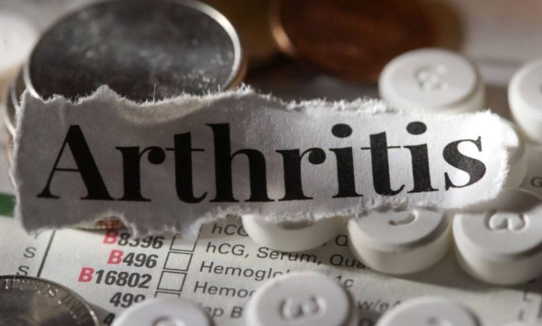 No Pills, No Surgery: Groundbreaking Discovery Offers Simple Solution for Arthritis Pain Relief