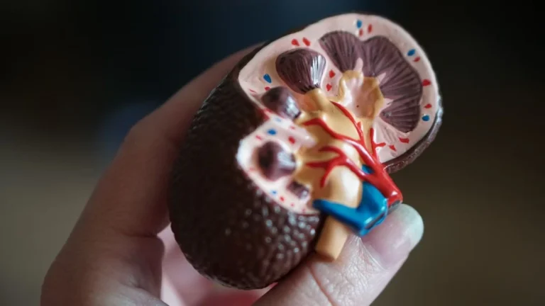 Over 1,000 Patients Await Kidney Transplants in Gauteng Alone Over 1,000 Patients Await Kidney Transplants in Gauteng Alone